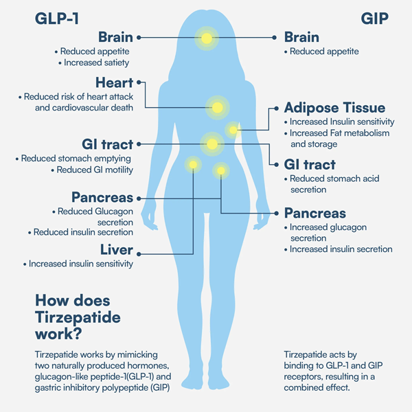 Body Diagram